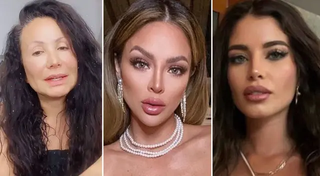 Famosas con operaciones que generaron polémica en Chollywood.