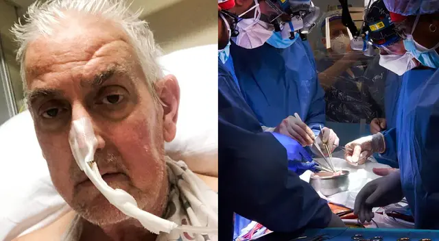 Los médicos estadounidenses no revelaron si estaba relacionado con alguna complicación del trasplante. Los médicos estadounidenses no revelaron si estaba relacionado con alguna complicación del trasplante.