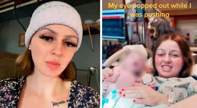Bethany Collins dijo que presionó tanto durante el trabajo de parto que uno de sus ojos salió de su órbita.