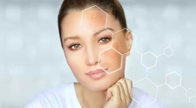 Conoce cómo erradicar manchas en el rostro Conoce cómo erradicar manchas en el rostro