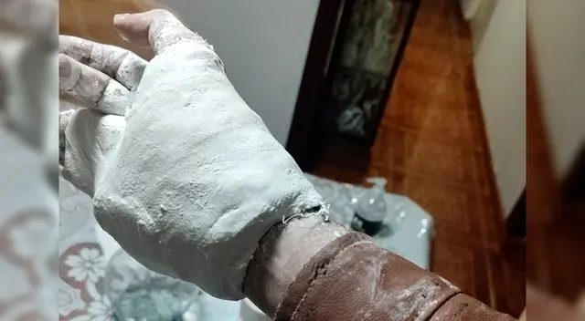 El joven contó a través de Twitter que sufrió un accidente en su moto. El joven contó a través de Twitter que sufrió un accidente en su moto.