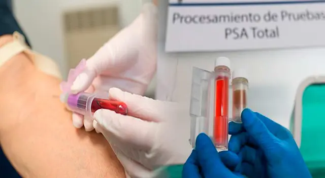 Pruebas gratuitas para detectar tempranamente un posible caso de cáncer de próstata