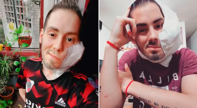 Sebastián tenía un sarcoma embrionario en el maxilar derecho y el tumor había avanzado en los últimos meses.