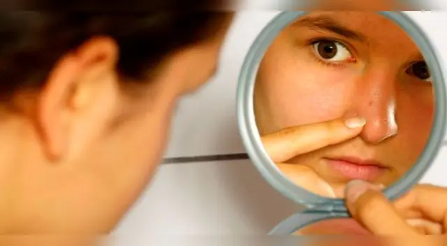 Muchas de estas enfermedades se deben por exponerse mucho al sol.