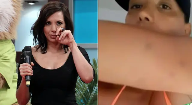 Mónica Cabrejos muestra moretones del día en el que presuntamente