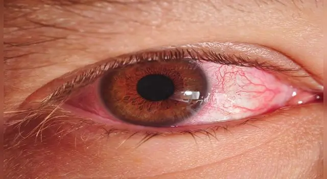 Conoce cómo erradicar el mal de ojo