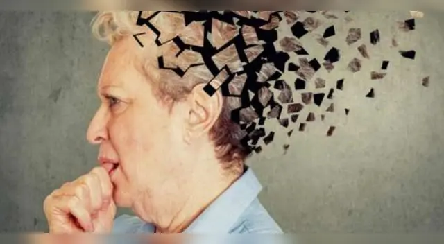 Conoce todo sobre los genes asociados al Alzheimer.