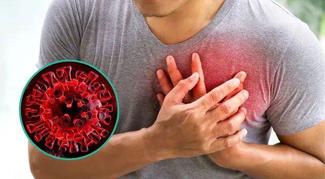 La infección del COVID-19 puede provocar arritmias. La infección del COVID-19 puede provocar arritmias.