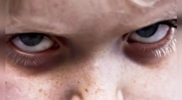 Aprende a erradicar el mal de ojo a través del uso de huevo. Aprende a erradicar el mal de ojo a través del uso de huevo.