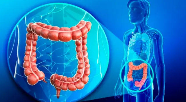 Muchas veces un cambio en la dieta diaria y estilo de vida puede solucionar el problema.