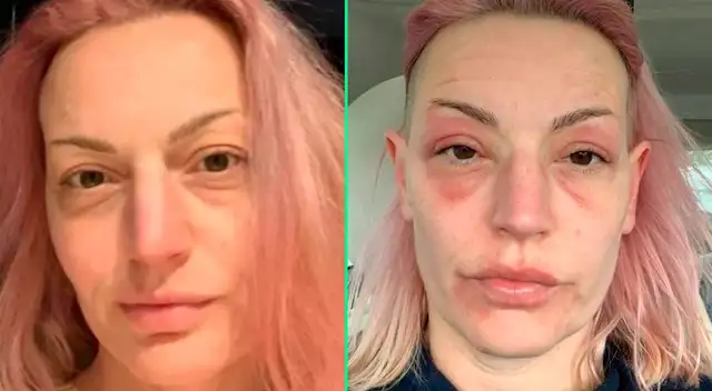 Michelle Flower recibió la ayuda de su médico de cabecera. Michelle Flower recibió la ayuda de su médico de cabecera.