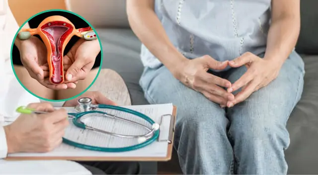 El VPH provoca cambios en las células que llevan al cáncer de cuello uterino.