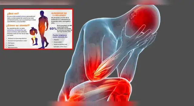 Síntomas del dolor neuropático localizado.