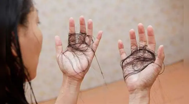 La pérdida de cabello tras haber sufrido COVID-19.