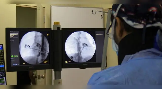 No se realizó cirugía abierta para curar a menores. No se realizó cirugía abierta para curar a menores.