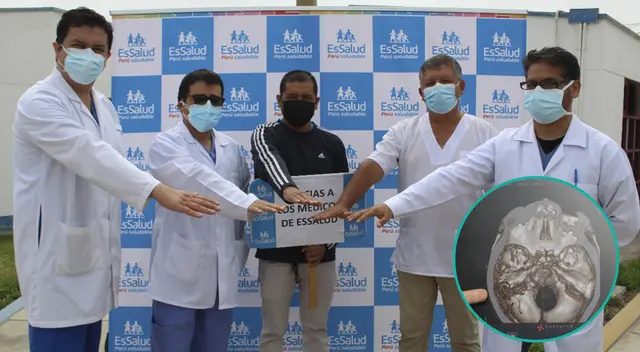 Médicos del hospital Sabogal le dan otra oportunidad de vida a paciente con malformación cerebral. Médicos del hospital Sabogal le dan otra oportunidad de vida a paciente con malformación cerebral.