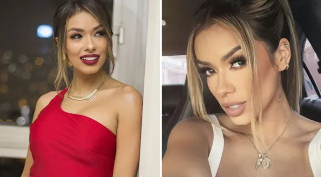 Shirley Arica revela su aplicación de botox. Shirley Arica revela su aplicación de botox.