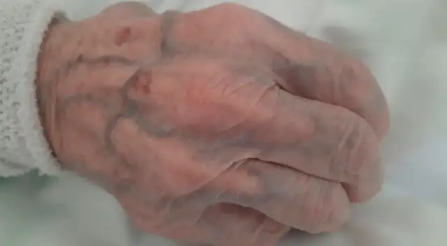 La adulta mayor cumplió 95 años el miércoles 4 de mayo.