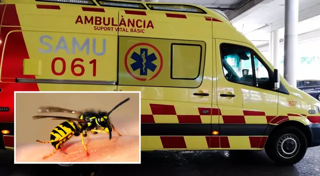 La anafilaxia es la reacción alérgica más grave que existe, y que puede llegar a ser mortal.