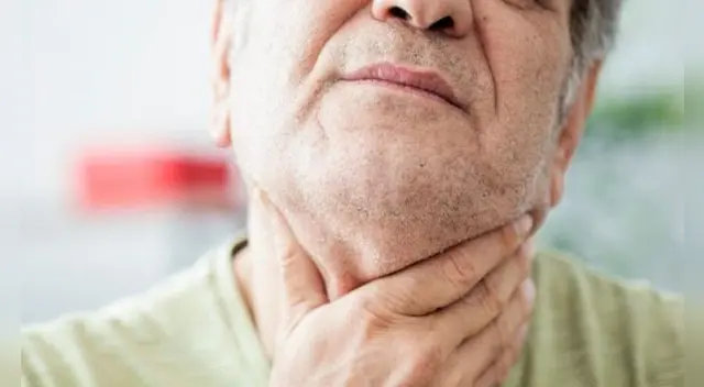 Uno de los signos de padecer diabetes es la sequedad en la boca