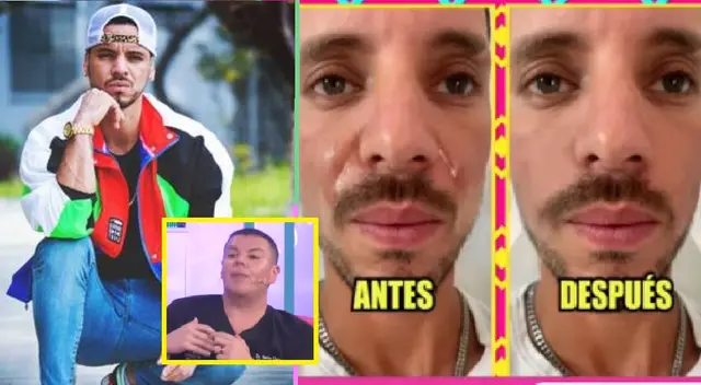 Especialista echa a Anthony Aranda con arreglitos y Peluchín se burla de él.