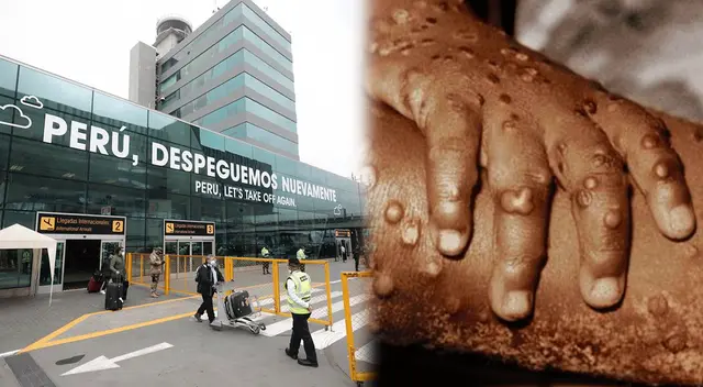 Especialista aseguró que es una enfermedad conocida y no hay que alarmarce.