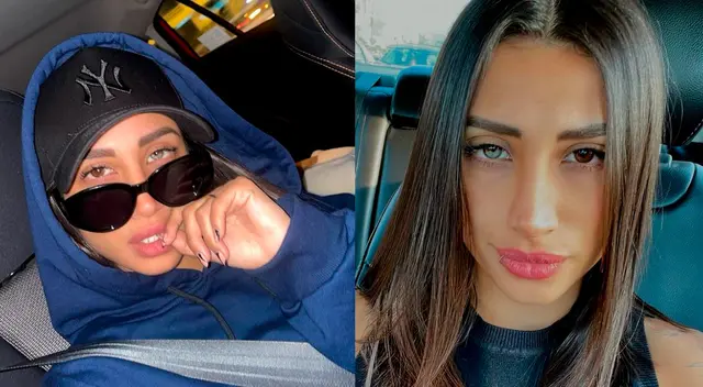 La exesposa de Sergio Peña, Valery Revello, señala que sus labios son naturales y no operados como afirmó el doctor. La exesposa de Sergio Peña, Valery Revello, señala que sus labios son naturales y no operados como afirmó el doctor.