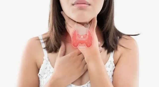 La tiroides aparece de un momento a otro y no distingue sexo.