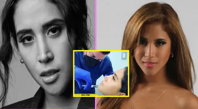 Melissa Paredes y su antes y después de retoquitos como 'reina de belleza'.