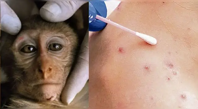 El paciente infectado en Argentina había regresado recientemente de España. El paciente infectado en Argentina había regresado recientemente de España.