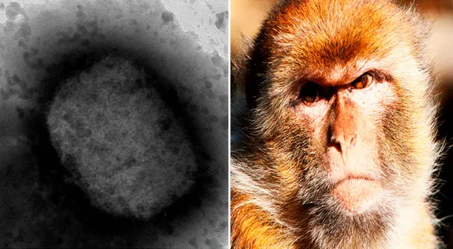 Funcionario mexicano explicó que la enfermedad se transmite de persona a persona por contacto directo, y que no se propaga por aire, agua o alimentos. Funcionario mexicano explicó que la enfermedad se transmite de persona a persona por contacto directo, y que no se propaga por aire, agua o alimentos.