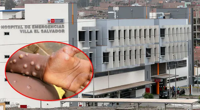 Enfermedad ya se encuentra en Argentina y Colombia y su ingreso al país es altamente probable. Enfermedad ya se encuentra en Argentina y Colombia y su ingreso al país es altamente probable.