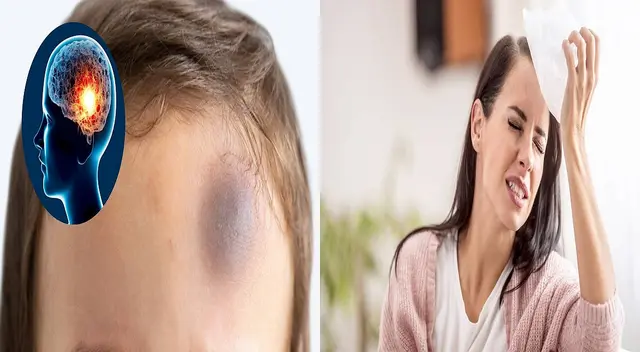 Sepa cuándo acudir a un médico luego de un golpe en la cabeza. Sepa cuándo acudir a un médico luego de un golpe en la cabeza.