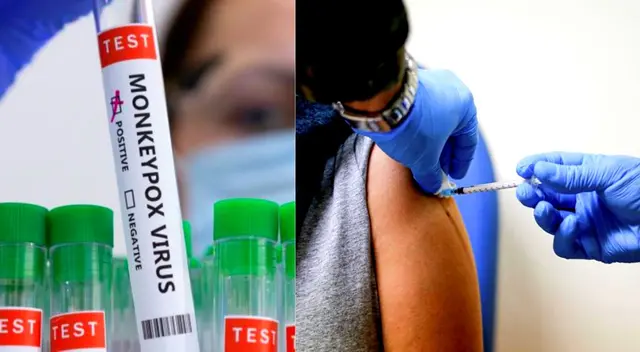 Vacuna contra la viruela