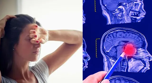 La biopsia es una forma para el diagnostico y tratar los tumores cerebrales.