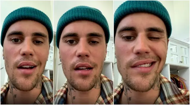 Justin Bieber sufre del síndrome de Ramsay Hunt. Justin Bieber sufre del síndrome de Ramsay Hunt.