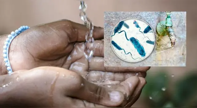 Preocupación. España ha detectado su primer caso de cólera autoctono desde los años 70.