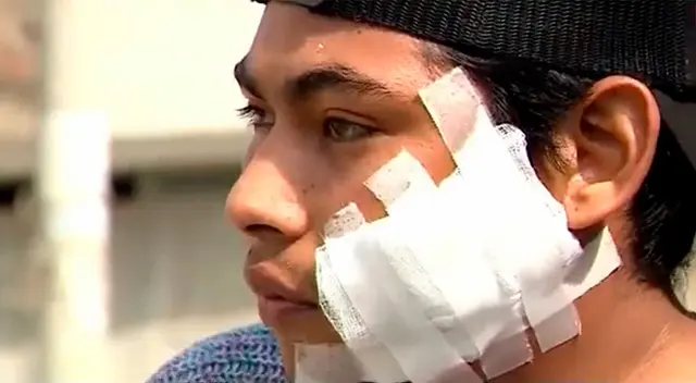 VES: joven atacado por dos pitbulls necesita dinero para tratamiento y dueño de perros lo encara [VIDEO]