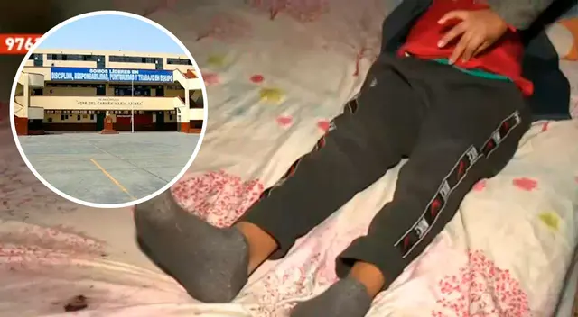 El menor tuvo que ser operado de urgencia debido a que terminó con el apéndice seriamente dañado. El menor tuvo que ser operado de urgencia debido a que terminó con el apéndice seriamente dañado.