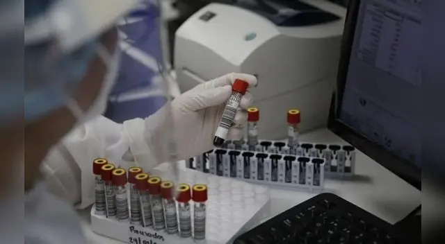 Conoce en esta nota que dicen los expertos del  INS sobre la mortalidad y letalidad del virus en Perú.