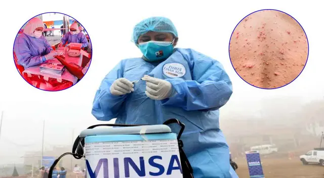 Conoce en esta nota la diferencia entre la viruela del mono y el coronavirus. Conoce en esta nota la diferencia entre la viruela del mono y el coronavirus.