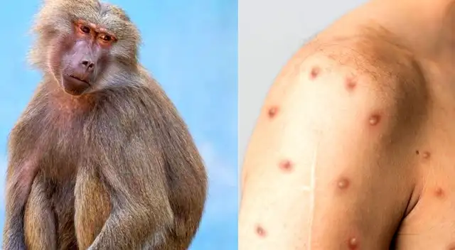 Lo mejor es guardar aislamiento para no contagiar al resto mientras te recuperas. Lo mejor es guardar aislamiento para no contagiar al resto mientras te recuperas.