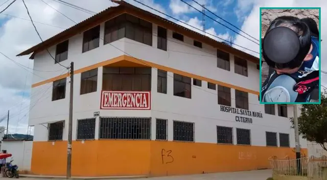Niño fue dado de alta del hospital Santa María, a pesar de tener una herida expuesta en la cabeza.