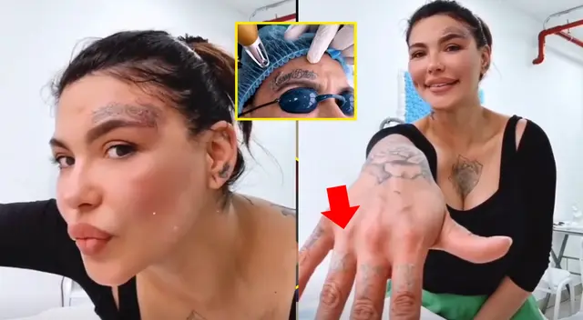 Angie Jibaja inicia borrado de todos sus tatuajes