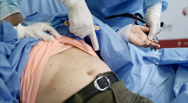 Entidad recomendó acudir a un centro de salud cercano en caso se presente síntomas. Entidad recomendó acudir a un centro de salud cercano en caso se presente síntomas.