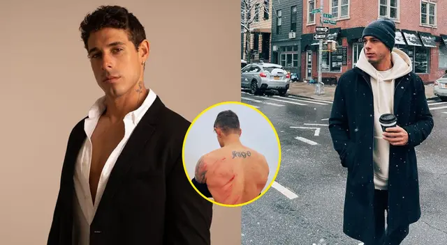 Hugo García sufre violento accidente y quedó con la espalda lastimada