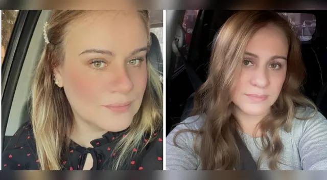 Lourdes Sacín habla sobre su parálisis facial.