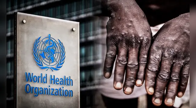 La OMS viene evaluando la posibilidad de elevar el nivel de alerta por brotes en todo el mundo. Foto: composición/AFP