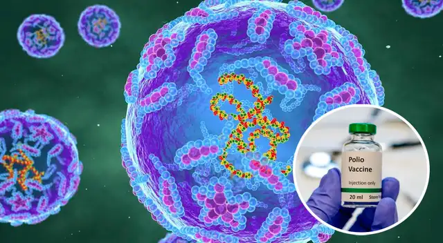 La polio ha paralizado y matado humanos durante siglos.