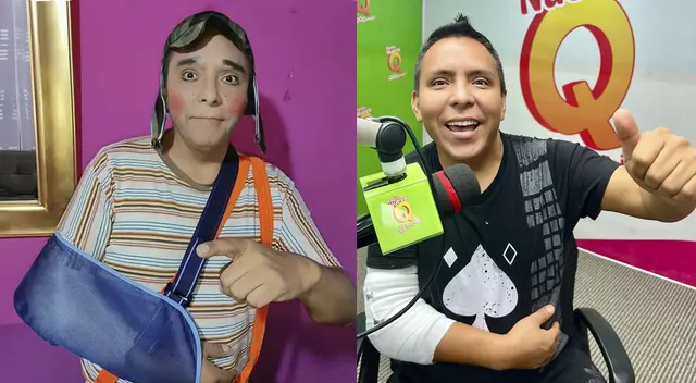 Edwin Sierra se accidentó en su circo y deberá seguir terapias para recuperar movimiento del brazo.